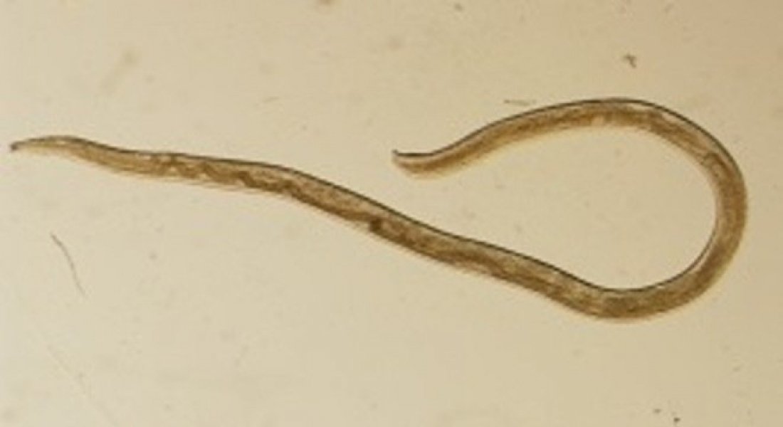 Pelo Mundo Mulher Fica Com Vermes Nos Olhos Apos Passar Por Nuvem De Moscas Notisul