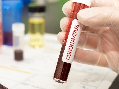 Braço do Norte registra 25 casos confirmados de coronavírus
