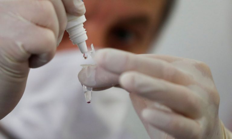 Coronavírus: Brasil tem quase 500 mil casos confirmados e 28.834 mortes