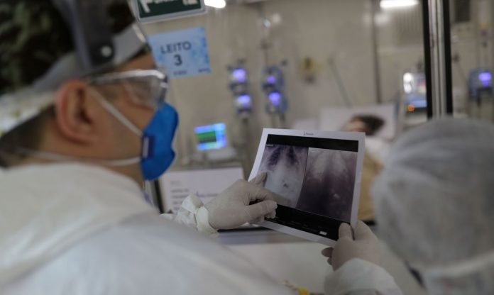 radiografia_de_torax_covid-19
