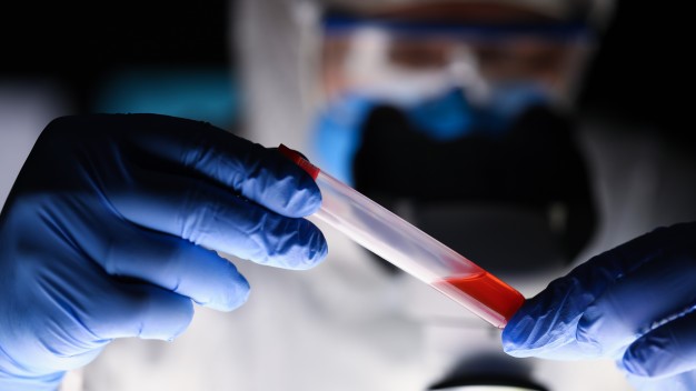 #Pracegover Na foto, químico examinando amostra de sangue
