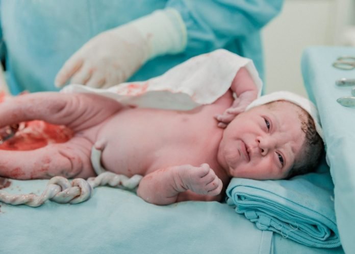 considerado-raro-bebe-de-brusque-nasce-com-no-duplo-no-cordao-umbilical-veja-fotos-whatsapp-image-2022-01-28-at-16.29.25