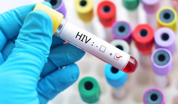 #ParaTodosVerem Na foto, um tubo de ensaio com sangue. Na frente há uma etiqueta onde está escrito HIV+